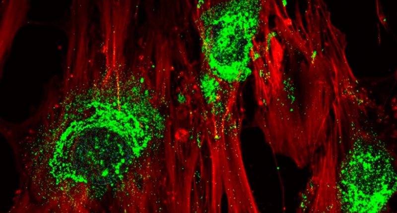 科学家通过声波将干细胞转变成骨头细胞