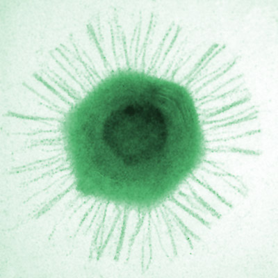 噬病毒体：能感染病毒的病毒