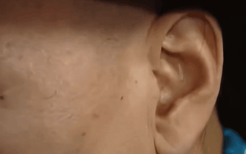 为什么有的人能够动自己的耳朵？