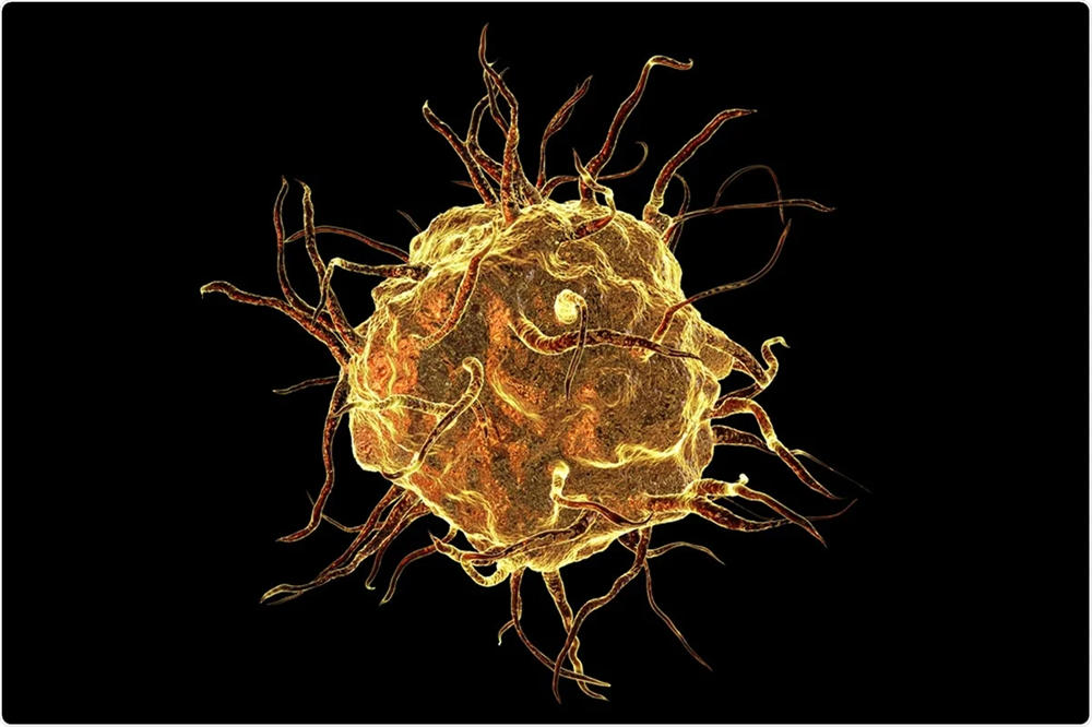 功能失调的巨噬细胞会导致严重的免疫疾病