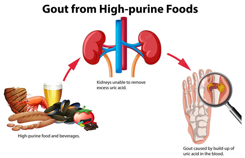 高嘌呤食物会影响肾脏健康